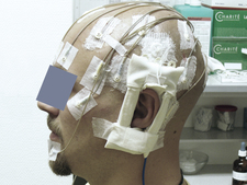 Testperson mit am Kopf aufgeklebten EEG-Elektroden und der am linken Ohr befestigten Flachantenne zur Exposition
