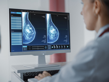 Images from mammography screening on a computer screen