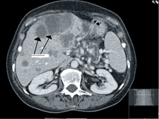 Computed tomography (CT)