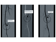 Fluoroscopy