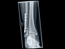 X-ray photograph